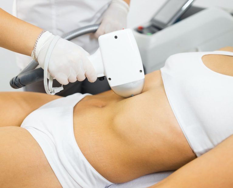 Woman on laser hair removal procedure